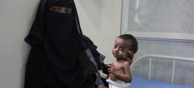 Looming famine in Yemen could put two million mothers at risk of death â€“ UN agency