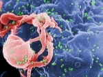 Cancer-fighting gene immunotherapy shows promise as treatment for HIV