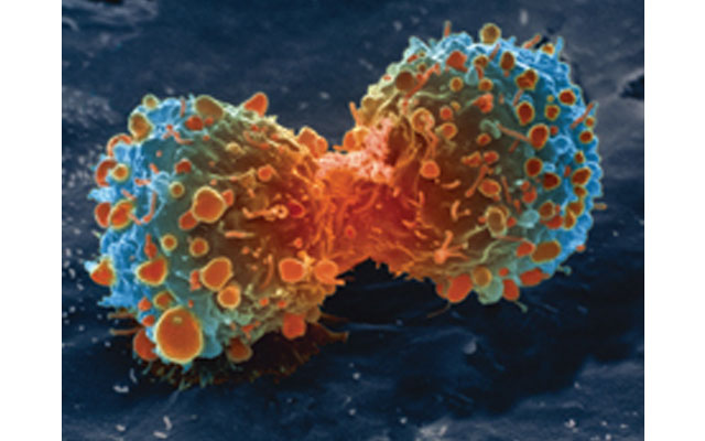 Research finds cancer hi-jacks natural cell process to survive
