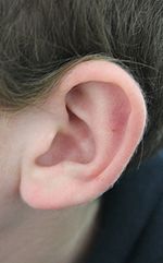 Ringing in ears keeps brain more at attention, less at rest, study finds