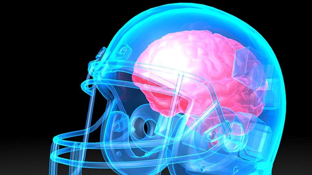 First study to show genotype may make some players more susceptible to concussion injuries