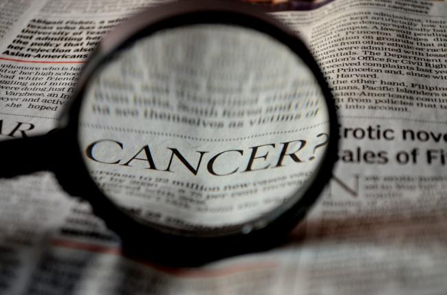AI approach outperformed human experts in identifying cervical precancer