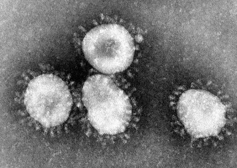 UK: Two Coronavirus cases confirmed