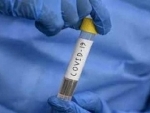 Italy's death toll from coronavirus rises to 31,908