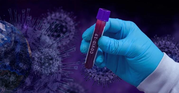 Spain's daily coronavirus death toll drops to 288