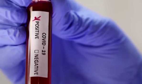 Belgium confirms 389 new coronavirus cases as daily deaths decline