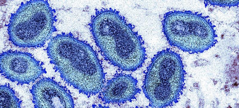 Monkeypox not presently a global public health emergency, says WHO