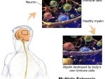 Scientists fabricate protein that can help study diseases like multiple sclerosis