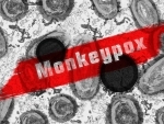 Southern Vietnam registers six monkey pox deaths