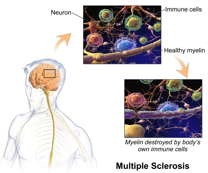 Scientists fabricate protein that can help study diseases like multiple sclerosis