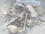 Kolkata: Human skulls, bones found in Behala