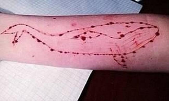 Blue Whale Challenge: Jodhpur girl jumps into lake, rescued 