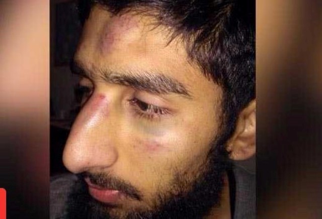 Haryana: Kashmiri students thrashed by mob after Friday prayers