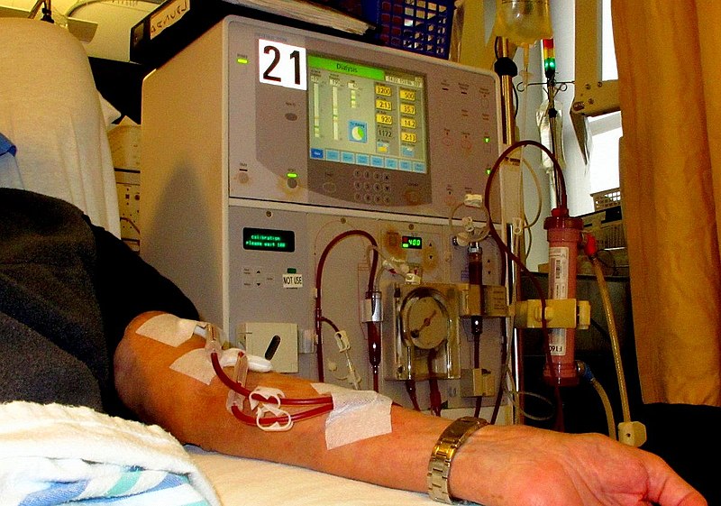 Jammu and Kashmir: Dialysis patients in Kupwara benefiting from new centre