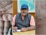 The curious case of ISRO scientist poisoning: Tapan Misra pins attack to his RISAT satellite work