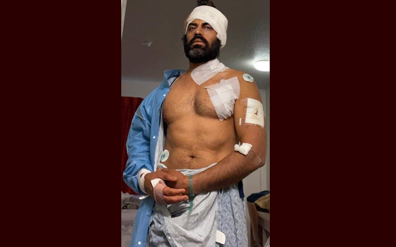 Punjabi actor Aman Dhaliwal attacked with knife in US