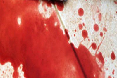 Injured BSF jawan dies in Jammu hospital