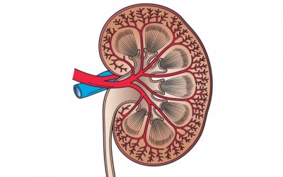 Chronic Kidney Disease may cause diabetes 