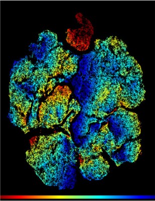Researchers identify possible pathway to reboot immune system after bone-marrow transplants