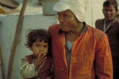 UN health agency launches global strategy to end leprosy   