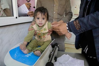 Malnutrition among children in Yemen at â€˜all-time high,â€™ warns UNICEF