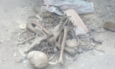 Kolkata: Human skulls, bones found in Behala