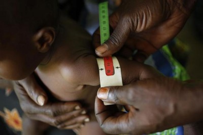 DR Congoâ€™s economy loses over $1 billion to child undernutrition, finds UN-backed study