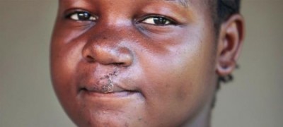 First-ever UN report on disability and development, illustrates inclusion gaps