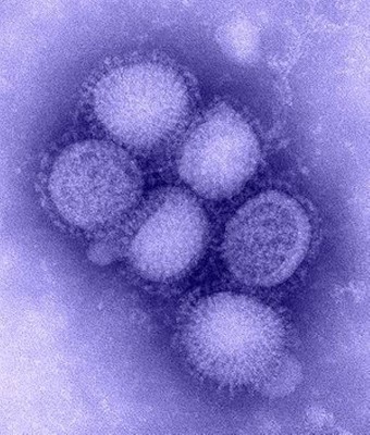 Swine flu claims three more lives in Gujarat