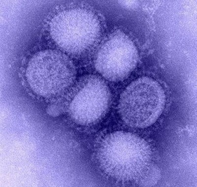 Infant dies of swine flu in Chandigarh