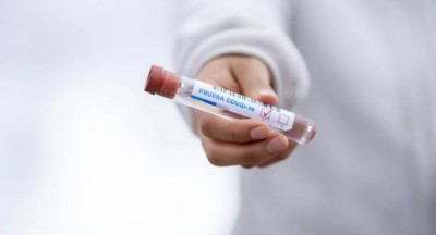 S Korea reports 67 more COVID-19 cases, 12,373 in total