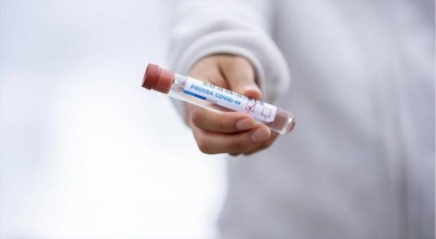 Visakhapatnam Steel Plant employee test positive for Covid-19