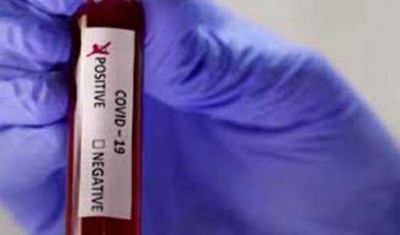 Maharashtra: Aurangabad reports third batch of COVID-19 cases