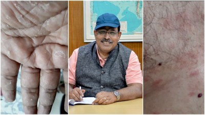 The curious case of ISRO scientist poisoning: Tapan Misra pins attack to his RISAT satellite work