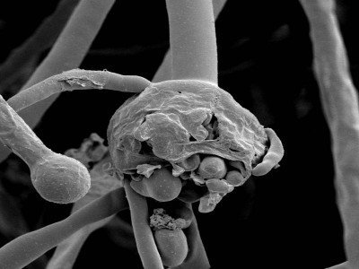 MSN Labs launches Posaconazole to treat Black Fungus