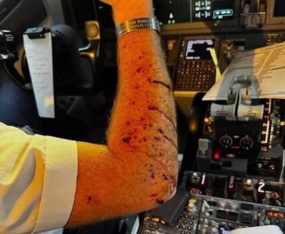 US: Boeing 737 MAX 8 windshield shatters mid-air after an unidentified object strikes; pilot injured