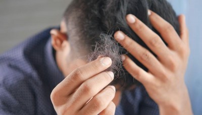 Losing hair fast? The hidden reasons no one told you about