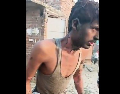 Man set on fire after dispute over prayer spot in Uttar Pradesh mosque, police probe all angles