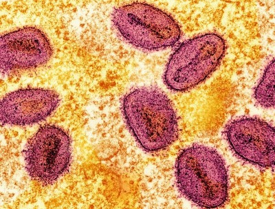 New recombinant mpox strain detected in UK and India; WHO calls for heightened surveillance