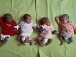 Jammu: Doctors manage birth of premature quadruplet