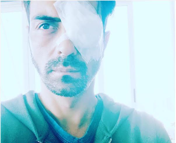 Arjun Rampal suffers eye injury