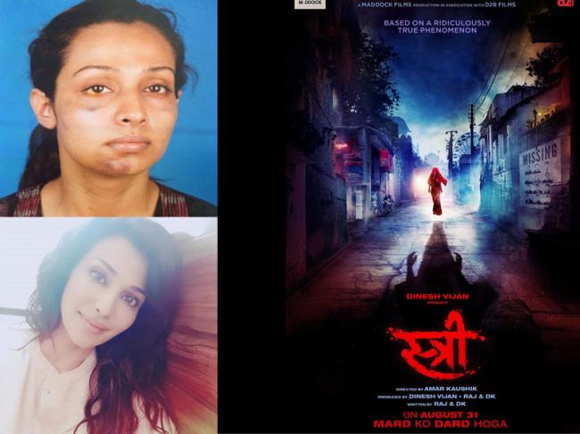 Stree actor Flora Saini accuses producer Gaurang Doshi of abuse, shares image of broken jaw on Facebook