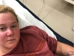 Actress Amy Schumer hospitalised for kidney infection, shares image on Instagram