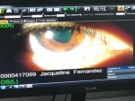 Jacqueline Fernandez suffers from permanent eye injury 
