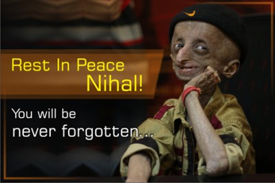 Nihal Bitla, face of Progeria in India, passes away