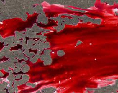 Man's bruised body found in Howrah park