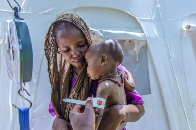  'Time running out' for 1.4 million children in 'man-made' crises in Africa, Yemen â€“ UNICEF