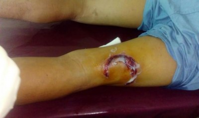 Protest turns violent in Manipur, seven UNC protesters injured