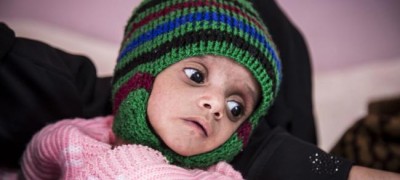 UN food agency appeals for access to key storage facility amid fight for Hudaydah