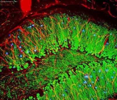 Compound prevents neurological damage, shows cognitive benefits in mouse model of Alzheimerâ€™s disease
